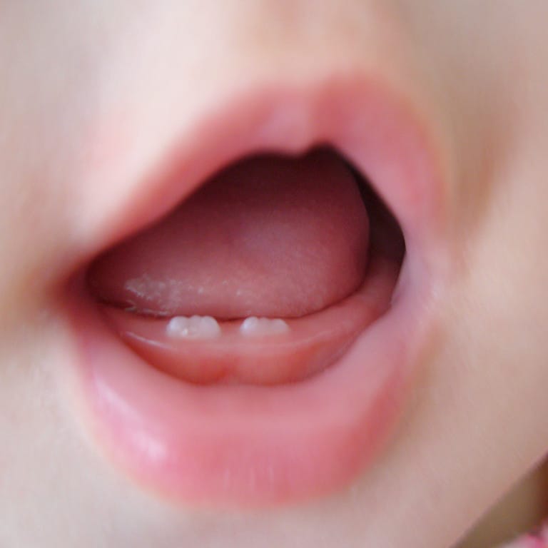 赤ちゃんの乳歯はいつ生えてくる？おむつのムーニー 公式 ユニ・チャーム