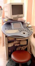 超音波検査の機械 （写真は4Dの機械）