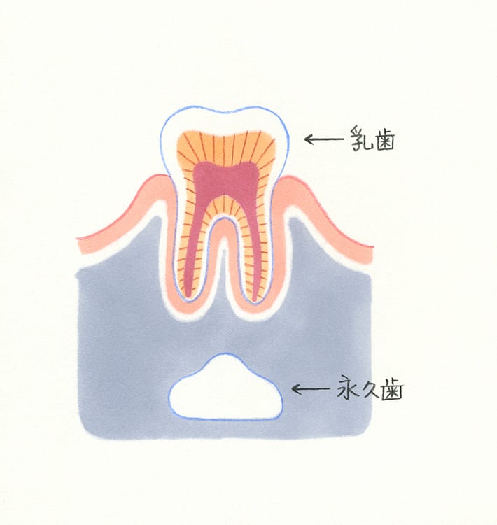 乳歯の虫歯は永久歯にも影響します 