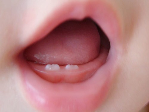 赤ちゃんの乳歯が生える時期と順番とは？虫歯の注意点についても解説！