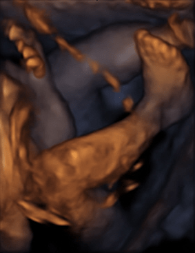 妊娠7ヶ月 妊娠24週 25週 26週 27週 の胎児と母体の状態 おむつのムーニー 公式 ユニ チャーム