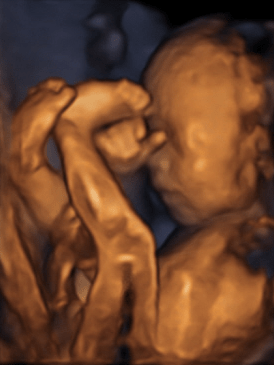 妊娠6ヶ月 妊娠週 21週 22週 23週 の胎児と母体の状態 おむつのムーニー 公式 ユニ チャーム