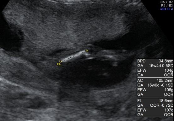 妊娠5ヶ月 妊娠16週 17週 18週 19週 の胎児と母体の状態 おむつのムーニー 公式 ユニ チャーム