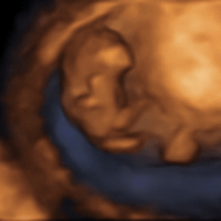 妊娠3ヶ月 妊娠8週 9週 10週 11週 の胎児と母体の状態 おむつのムーニー 公式 ユニ チャーム