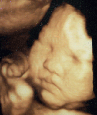 妊娠における超音波検査 エコー検査 のホントの目的とは おむつのムーニー 公式 ユニ チャーム