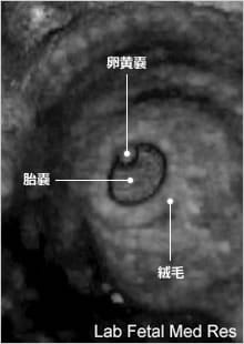 妊娠初期の超音波検査 おむつのムーニー 公式 ユニ チャーム