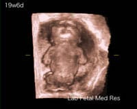 妊娠中期 後期の超音波検査 妊娠中の検査シリーズ おむつの