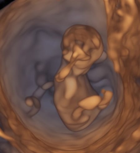 妊娠11週のエコー写真は おなかの大きさは おむつのムーニー 公式 ユニ チャーム