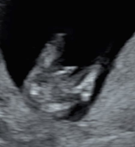 妊娠14週 胎児の様子は 母体の状態は おむつのムーニー 公式 ユニ チャーム