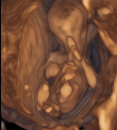 妊娠14週 胎児の様子は 母体の状態は おむつのムーニー 公式 ユニ