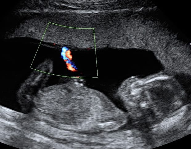 妊娠15週 胎児の様子は 母体の状態は おむつのムーニー 公式 ユニ チャーム