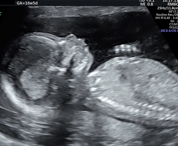 妊娠16週 妊婦と胎児の様子が知りたい おむつのムーニー 公式 ユニ チャーム