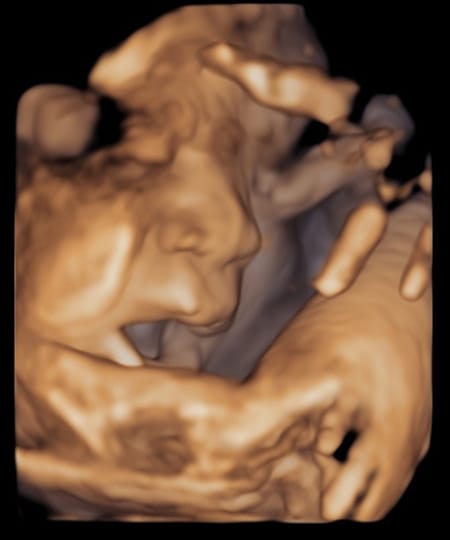 妊娠35週 胎児と妊婦の様子は 出産準備ok おむつのムーニー 公式 ユニ チャーム
