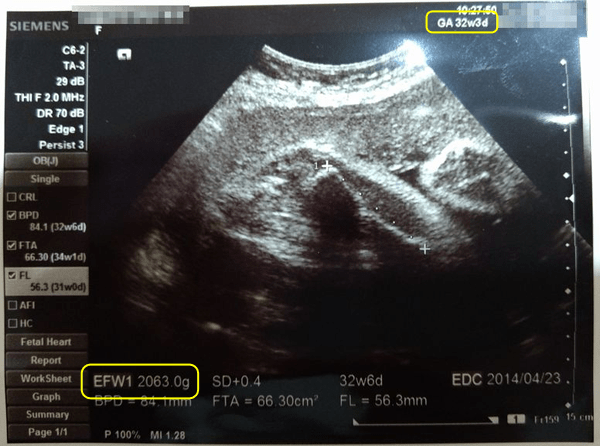 母子手帳 胎児発育曲線 新生児の成長曲線 の見方と活用法 おむつのムーニー 公式 ユニ チャーム